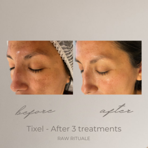 17 Tixel before and after, photo 7 of 18