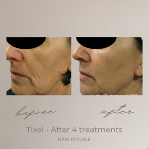 24 Tixel before and after, photo 8 of 18