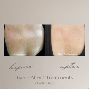 26 Tixel before and after, photo 10 of 18