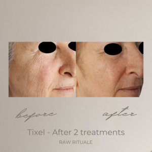 27 Tixel before and after, photo 11 of 18