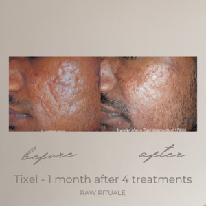 28 Tixel before and after, photo 12 of 18