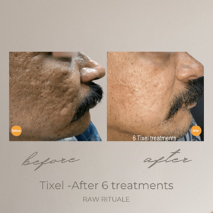 35 (1) Tixel before and after, photo 14 of 18