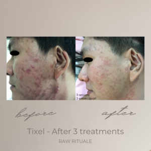36 Tixel before and after, photo 16 of 18