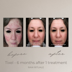 37 Tixel before and after, photo 17 of 18
